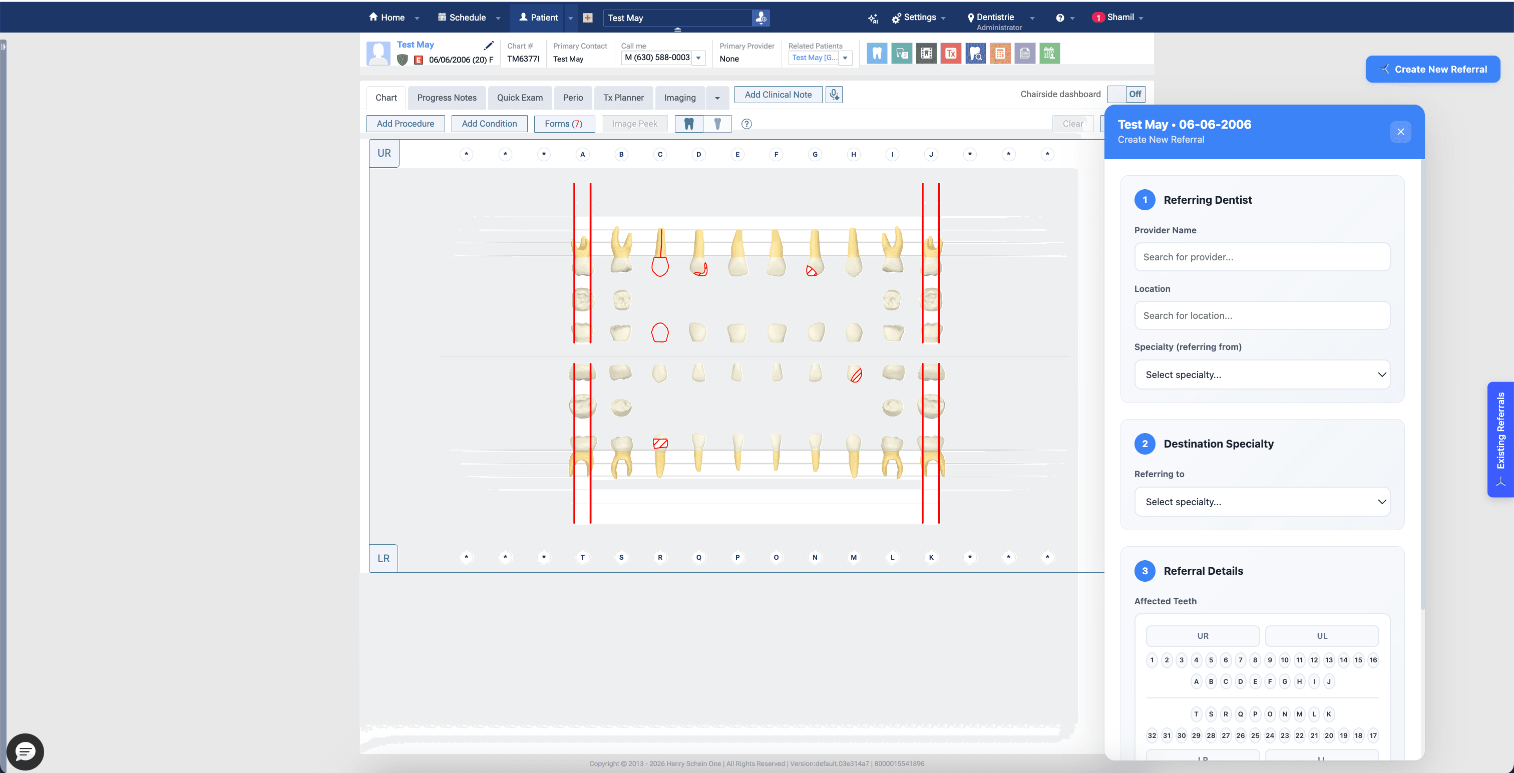 Furca referral workflow embedded beside a Dentrix Ascend patient chart